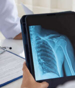 Check-up ortopédico, quem deve fazer e por quê